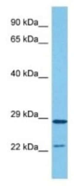 HDHD1A Rabbit anti-Human, Polyclonal, Novus Biologicals 100 &mu;g; Unconjugated:Antibodies,